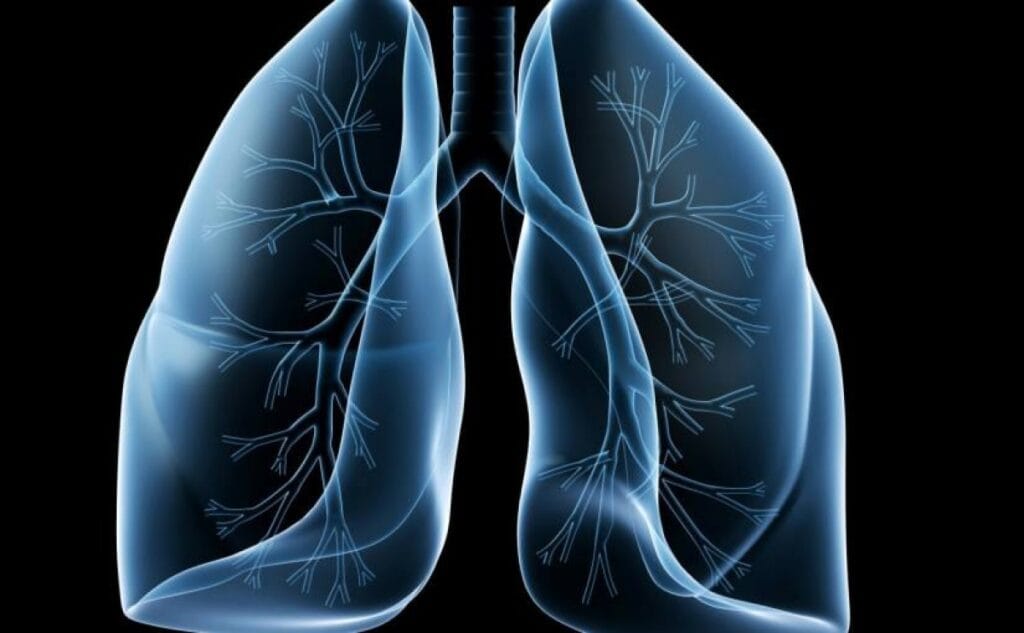 México declara debilidad ante enfermedades pulmonares